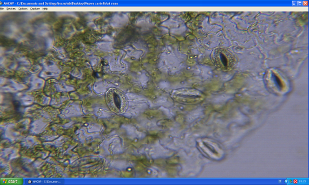 Cellule vegetali_ stomi di sedano con cellule di guardia_40 x